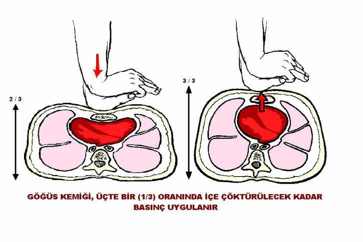 kalp masajı